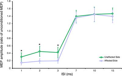 Cortical Inhibitory Imbalance in Functional Paralysis